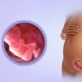 Informe explicación del problema de la desnudez, el vómito y la toxicosis (preeclampsia temprana) durante el embarazo: causas de culpabilidad y tratamiento eficaz